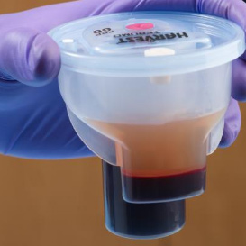 bonemarrow-aspirate bonemarrow-aspirate